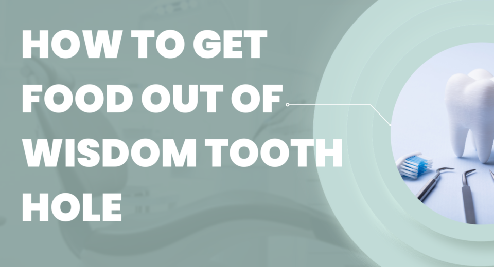 How to Get Food Out of Wisdom Tooth Hole