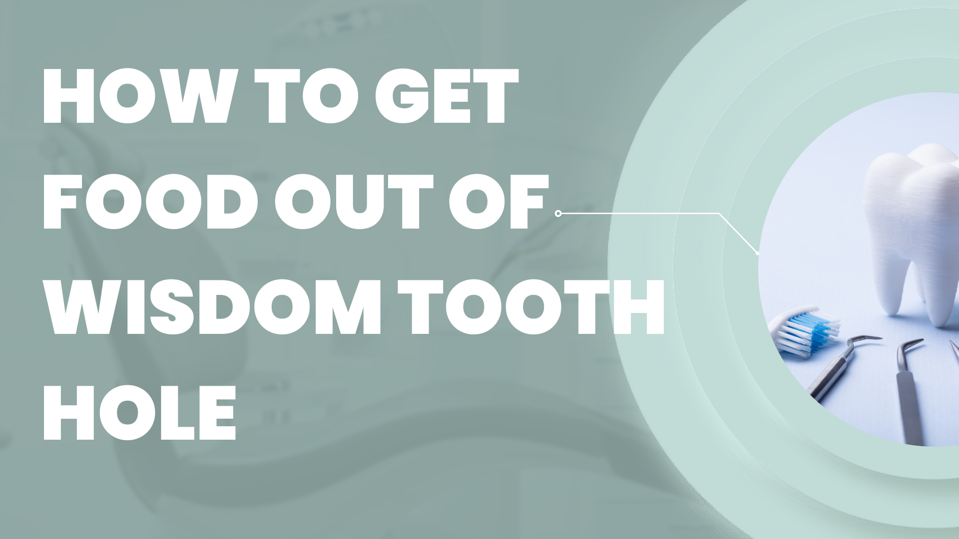 How to Get Food Out of Wisdom Tooth Hole